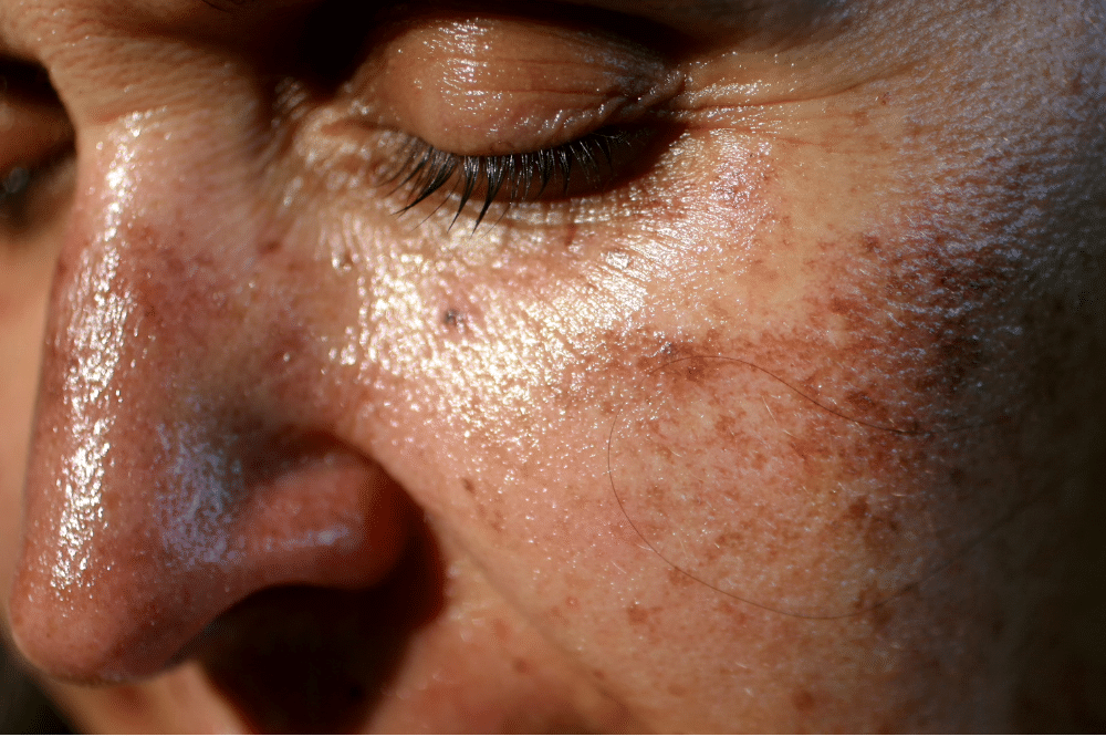 Safe Skin Lightening Practices Without Long-Term Damage